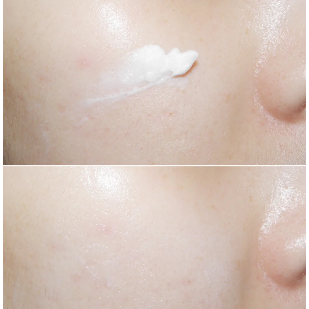 Korea Mizon Hautregenerierende – Luxury Skincare Serum Bewertung und Preis